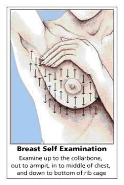 Breast Exam