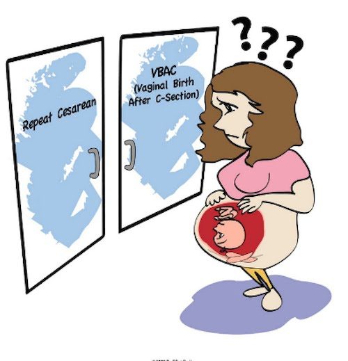 A Follow Up – C Section vs. VBAC