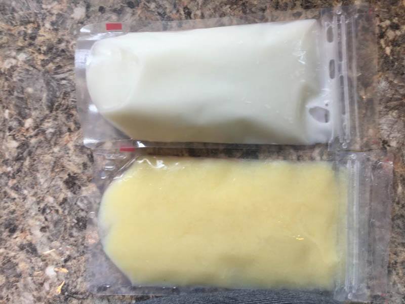 Mother's Photo of Adapting Breast Milk Explains Her Why